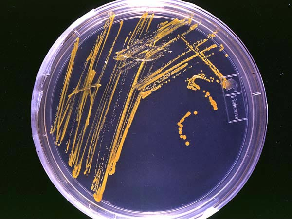 image of bacterial growth of a sample.