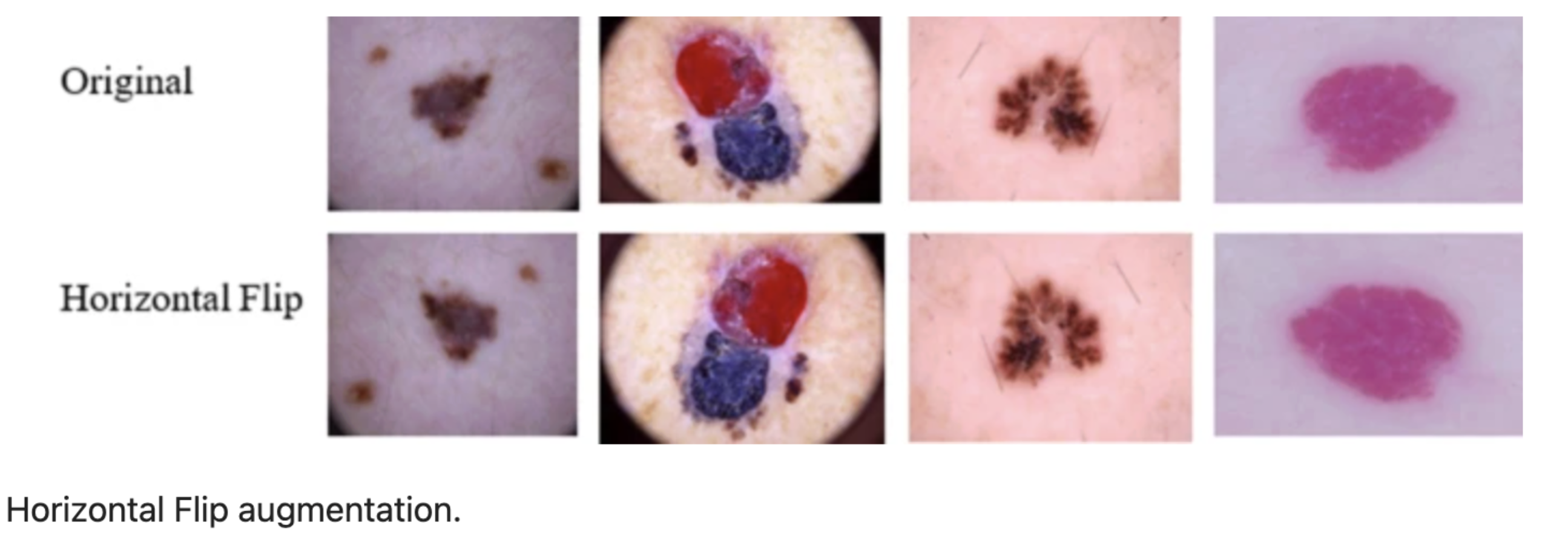 Example of horizontal flip augmentation